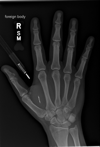 hand01