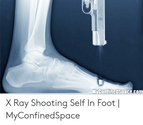 myconfinedspace-com-x-ray-shooting-self-in-foot-myconfinedspace-49366049